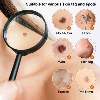 Laser Dark Spot Remover for Pimples, Tattoo, and Skin Tag Removal...